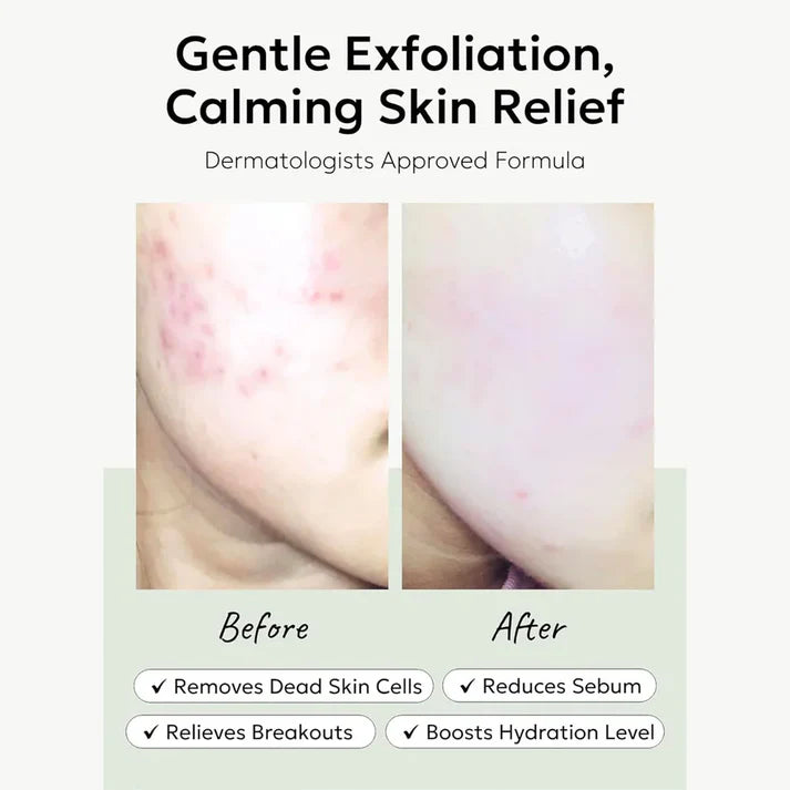 Celimax Ji.Woo.Gae Heartleaf BHA Peeling Pad