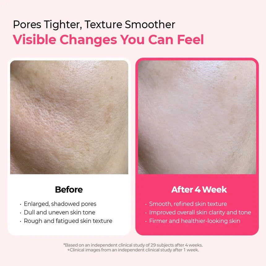 Dr. Melaxin Cemenrete Cyano Pink Spicule Serum 30 ml